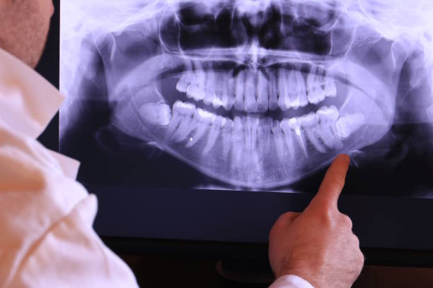 Best Emergency Care for Gum Disease in Palmdale, CA