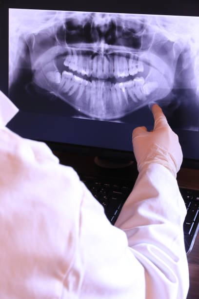 Best Knocked-Out Tooth (Avulsed Tooth) Treatment in Palmdale, CA